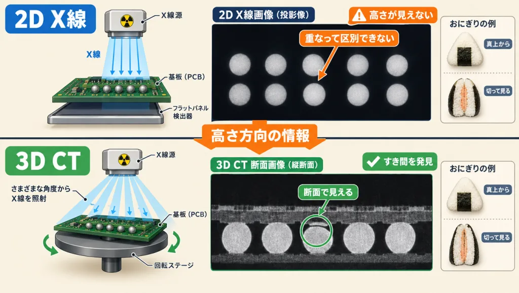 2D X線と3D CTの比較図。2D X線は投影像なのでボールが重なって高さが分からず、3D CTは断面像でボールのすき間(ヘッドインピロー)が見える。おにぎりを真上と切って見る違いにたとえている